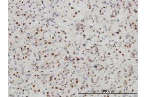 Immunoperoxidase of monoclonal antibody to SAE1 on formalin-fixed paraffin-embedded human adrenal gland.