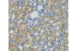 Immunohistochemistry of paraffin-embedded Rat kidney using INPP5J Polyclonal Antibody at dilution of 1:100 (40x lens). (INPP5J anticorps)