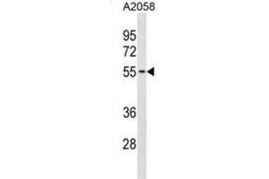 Western Blotting (WB) image for anti-Thioredoxin-Related Transmembrane Protein 3 (TMX3) antibody (ABIN3001033) (TMX3 anticorps)