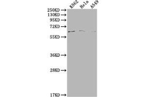 Western Blot Positive WB detected in: K562 whole cell lysate, Hela whole cell lysate, A549 whole cell lysate All lanes: MAP3K7 antibody at 1:500 Secondary Goat polyclonal to rabbit IgG at 1/50000 dilution Predicted band size: 68, 65, 57, 54 kDa Observed band size: 68 kDa