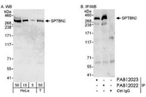 Western blot analysis of SPTBN2 in HeLa whole cell lysate (5, 15 and 50 ug for WB; 1 mg for IP, 20% of IP loaded) and HEK 293T (Bosc 23) (T : 50 ug) cells with SPTBN2 polyclonal antibody . (Spectrin, Beta, Non-erythrocytic 2 (SPTBN2) (C-Term) anticorps)