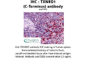 Image no. 1 for anti-Thioredoxin Reductase 1 (TXNRD1) (C-Term) antibody (ABIN1740489) (TXNRD1 anticorps  (C-Term))