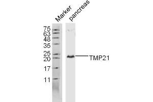 Lane 1: Mouse pancreas lysates probed with TMP21 Polyclonal Antibody, Unconjugated  at 1:300 overnight at 4˚C. (TMED10 anticorps  (AA 101-200))