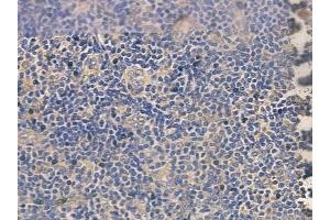 ABIN6260744 and ABIN6272626 at 1/100 staining human normal tonsil tissue by IHC-P. (CEACAM8 anticorps  (N-Term))