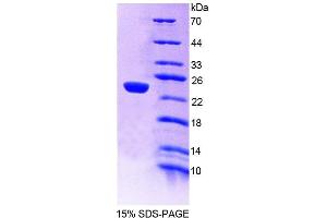 SDS-PAGE analysis of Mouse GaA Protein.