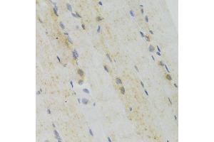 Immunohistochemistry of paraffin-embedded mouse skeletal muscle using GEMIN2 Antibody. (SIP1 anticorps)
