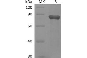 Western Blotting (WB) image for Growth Arrest-Specific 6 (GAS6) (Active) protein (His tag) (ABIN7319834)