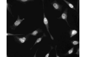 Immunofluorescent staining of HeLa (ATCC CCL-2) cells.