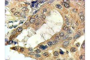 Immunohistochemistry (4μg/ml) staining of paraffin embedded Human Prostate. (SRD5A1 anticorps  (N-Term))