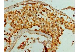 Immunohistochemistry of paraffin-embedded human testis tissue using ABIN7158724 at dilution of 1:100