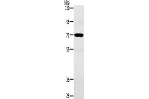 Gel: 6 % SDS-PAGE, Lysate: 40 μg, Lane: Mouse heart tissue, Primary antibody: ABIN7191964(POU6F2 Antibody) at dilution 1/200, Secondary antibody: Goat anti rabbit IgG at 1/8000 dilution, Exposure time: 30 seconds (POU6F2 anticorps)