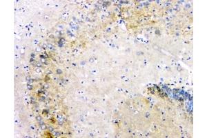 Flow cytometry testing of human PC-3 cells with Amyloid beta antibody at 1ug/10^6 cells (blocked with goat sera) (APP anticorps  (C-Term))