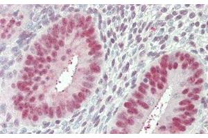 Detection of NCL in Human Uterus Tissue using Polyclonal Antibody to Nucleolin (NCL)