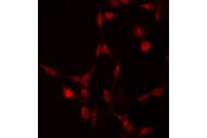 ABIN6267512 staining 293 by IF/ICC. (STAT5A anticorps  (pSer780))
