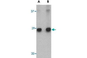 Western blot analysis of ELOVL6 in human brain tissue lysate with ELOVL6 polyclonal antibody  at (A) 1 and (B) 2 ug/mL . (ELOVL6 anticorps  (C-Term))