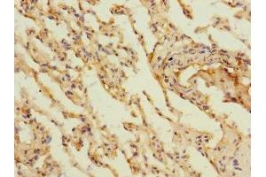 Immunohistochemistry of paraffin-embedded human lung tissue using ABIN7158886 at dilution of 1:100 (MARCO anticorps  (AA 421-520))