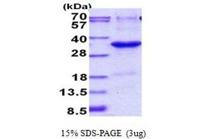 SDS-PAGE (SDS) image for JAZF Zinc Finger 1 (JAZF1) (AA 1-243) protein (His tag) (ABIN5852948)