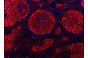 IF analysis of Cytokeratin 2e/KRT2 using anti-Cytokeratin 2e/KRT2 antibody (ABIN7600644).