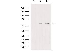 Western blot analysis of extracts from various samples, using CDKL2 Antibody. (CDKL2 anticorps  (Internal Region))