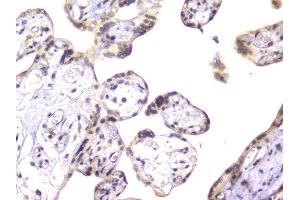 IHC analysis of EWSR1 using anti-EWSR1 antibody (ABIN6719313). (EWSR1 anticorps  (Middle Region))