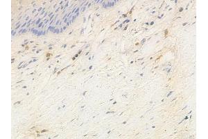 ABIN6263940 and ABIN6266908 at 1/100 staining human cervical carcinoma by IHC-P. (CDKN2C anticorps  (C-Term))