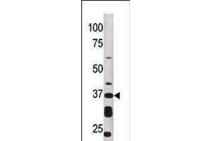 Western blot analysis of anti-ART1 Pab in HepG2 cell line lysate (35ug/lane) (ART1 anticorps  (AA 210-240))