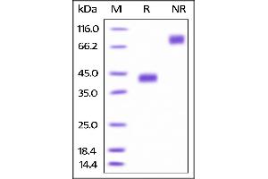 Biotinylated Human BCMA , Fc Tag on SDS-PAGE under reducing (R) and no-reducing (NR) conditions. (BCMA Protein (AA 1-54) (Fc Tag,AVI tag,Biotin))