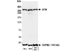 Western Blotting (WB) image for anti-Ataxia Telangiectasia Mutated (ATM) (AA 2550-2600) antibody (ABIN7795796)