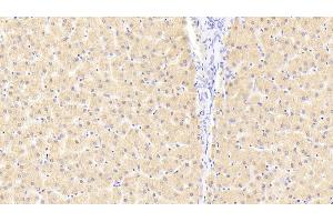 Detection of FKBPL in Human Liver Tissue using Polyclonal Antibody to FK506 Binding Protein Like Protein (FKBPL)