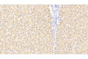 Detection of FKBPL in Human Liver Tissue using Polyclonal Antibody to FK506 Binding Protein Like Protein (FKBPL) (FKBPL anticorps  (AA 1-349))