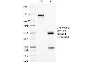 SDS-PAGE Analysis Purified Phosphotyrosine Mouse Monoclonal Antibody (PY20). (Phosphotyrosine anticorps)