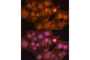 Immunofluorescence analysis of C6 cells using MDM2 antibody (ABIN6133186, ABIN6143671, ABIN6143672 and ABIN6217278) at dilution of 1:100. (MDM2 anticorps  (AA 200-430))