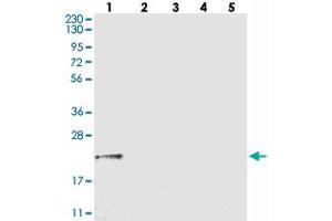 Western blot analysis of Lane 1: RT-4, Lane 2: U-251 MG, Lane 3: Human Plasma, Lane 4: Liver, Lane 5: Tonsil with GGCT polyclonal antibody . (GGCT anticorps)