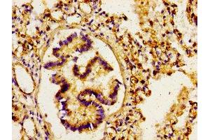 anti-rho GTPase Activating Protein 1 (ARHGAP1) (AA 216-308) antibody