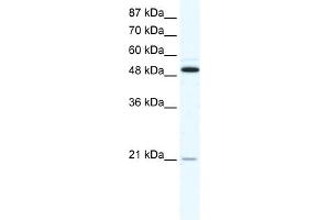 WB Suggested Anti-TNFRSF11B Antibody Titration:  1. (Osteoprotegerin anticorps  (N-Term))