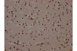 IHC image of ABIN7127654 diluted at 1:100 and staining in paraffin-embedded human brain tissue performed on a Leica BondTM system. (Recombinant MAPK14 anticorps)