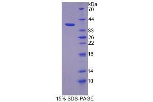 Image no. 1 for TANK-Binding Kinase 1 (TBK1) (AA 9-310) protein (His tag) (ABIN4990650)