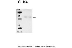 Sample type: human microvascular endothelial cells (25ug)Primary Dilution: 1:1000Secondary Antibody: Goat anti-Rabbit-HRPSecondary Dilution: 1:5000Image Submitted by: Andreas Eisenreich Charite Universitatsmedizin Berlin