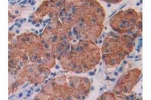 DAB staining on IHC-P; Samples: Human Stomach Tissue