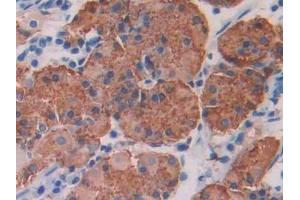 DAB staining on IHC-P; Samples: Human Stomach Tissue (IRAK1 anticorps  (AA 212-440))