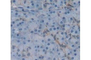 IHC-P analysis of Human Tissue, with DAB staining. (TSPAN1 anticorps  (AA 112-215))