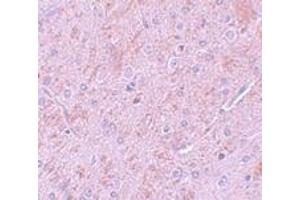 Immunohistochemistry (IHC) image for anti-Protein Inhibitor of Activated STAT, 2 (PIAS2) (N-Term) antibody (ABIN1031511) (PIAS2 anticorps  (N-Term))