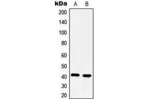 Western blot analysis of 5-HT4 expression in HeLa (A), Jurkat (B) whole cell lysates.