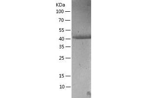Western Blotting (WB) image for Bromodomain Containing 3 (BRD3) (AA 29-417) protein (His-IF2DI Tag) (ABIN7122049)