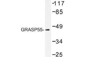Image no. 1 for anti-Golgi Reassembly Stacking Protein 2, 55kDa (GORASP2) antibody (ABIN317911) (GORASP2 anticorps)