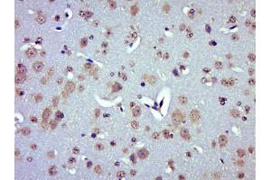 Paraformaldehyde-fixed, paraffin embedded Mouse brain Antigen retrieval by boiling in sodium citrate buffer (pH6.