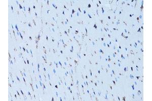 Immunohistochemistry of paraffin-embedded rat heart using FABP4 antibody.