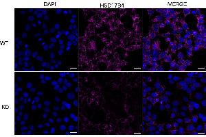 Immunocytochemical staining of HeLa cells using HSD17B4 antibody (ABIN7799015), 1:1,000), Top panel: wild-type (WT), Bottom panal: HSD17B4 shRNA knockdown (KD). (HSD17B4 anticorps)