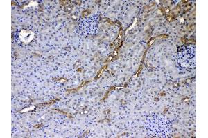 IHC analysis of GALE using anti-GALE antibody . (GALE anticorps  (AA 1-340))