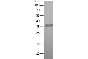 Western Blotting (WB) image for SLIT and NTRK-Like Family, Member 6 (SLITRK6) (AA 630-841) protein (His tag) (ABIN7125116)